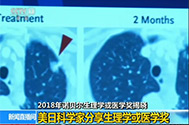 【新闻直播间】2018年诺贝尔心理学或医学奖揭晓：美日科学家分享心理学或医学奖